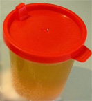 Urinbecher