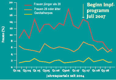 Reduktion von Genitalwarzen nach Einführung der HPV-Impfung