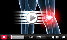 Arthrose-Schmerzen