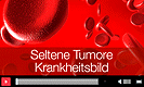 Seltene Tumore Krankheitsbild