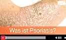 Was ist Psoriasis?