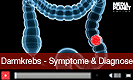 Darmkrebs - Symptome & Diagnose