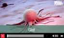 GIST