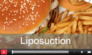 Liposuction