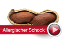 Allergischer Schock