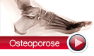 Osteoporose, Knochenschwund