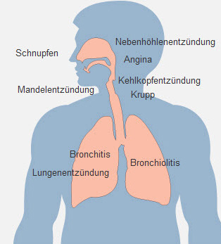 Atemwegserkrankungen