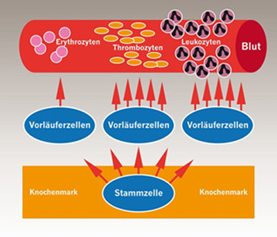 Gestörte Blutbildung im Knochenmark