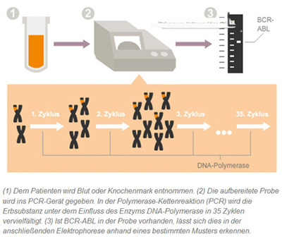 Die PCR Methode 