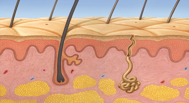 Acne Inversa: Hautentzündungen und schmerzhafte Knoten und Abszesse