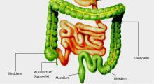 Appendizitis: Blinddarmentzündung