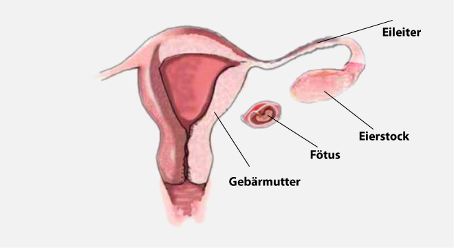 Gebärmutter ohne schwangerschaft ultraschall Eileiterschwangerschaft »