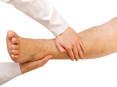 Beinvenenthrombosen: Schwere Beine, Schwellungen, Rötungen