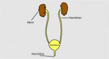 Blasensteine: Harnsteine in der Blase