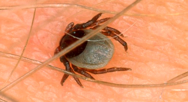 Lyme-Borreliose: Zecken übertragen das Virus