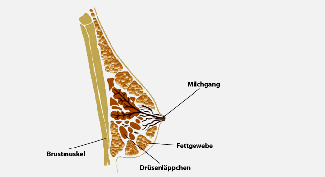 Mastopathie: gutartige Veränderungen der weiblichen Brust.