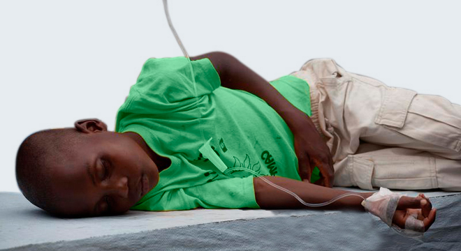 Cholera: Erbrechen, Durchfall, hoher Flüssigkeitsverlust