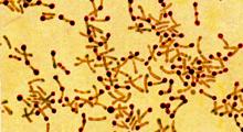 Diphtherie: Bakterium Corynebacterium diphtheriae