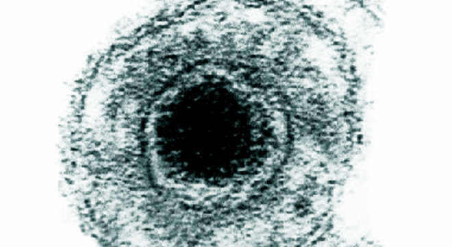 Dreitagefieber: Herpesvirus via Husten, Niesen, Speichel