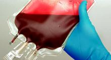 Ebola-Fieber: Bluttransfusionen können nötig werden