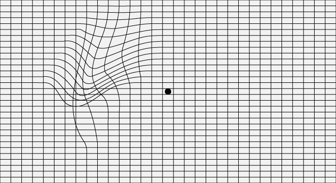 Makuladegeneration: Selbsttest mit dem Amsler-Gitternetz