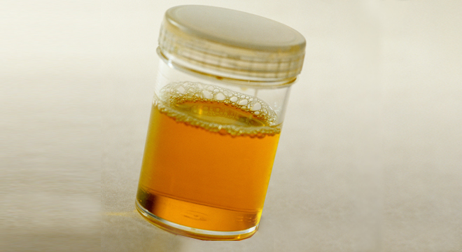Trinken trotz wenig viel urin Häufiges Wasserlassen: