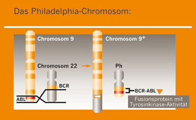 Philadelphia Chromosom