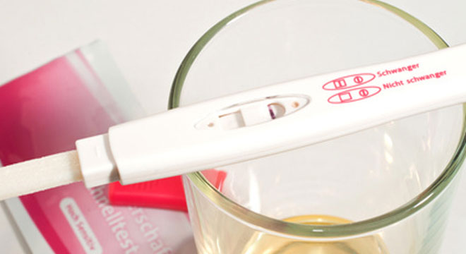 Die Chorionzottenbiopsie wird in der Frühschwangerschaft durchgefüht